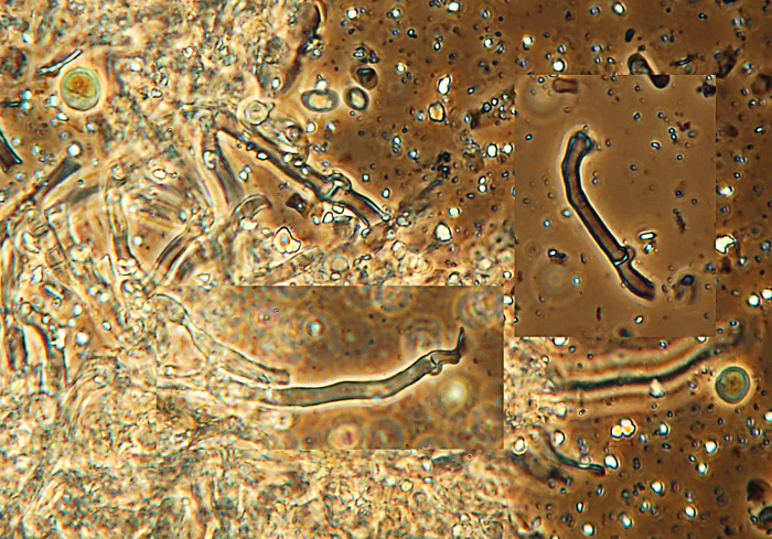 ritrovamento 1 (Hyphodontia sambuci)